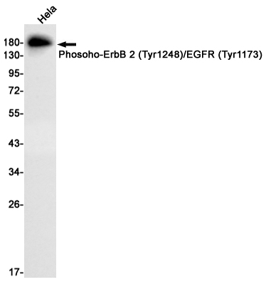 1 - Phosoho-HER2 (Tyr1248/Tyr1173) Rabbit mAb AP74962