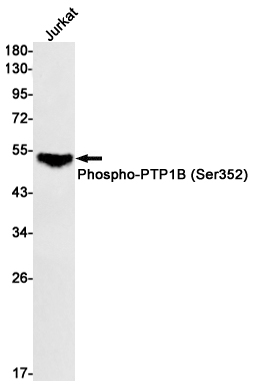 1 - Phospho-PTP1B (Ser352) Rabbit mAb AP74964