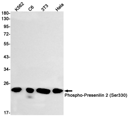 1 - Phospho-Presenilin 2/AD5 (Ser330) Rabbit mAb AP74965