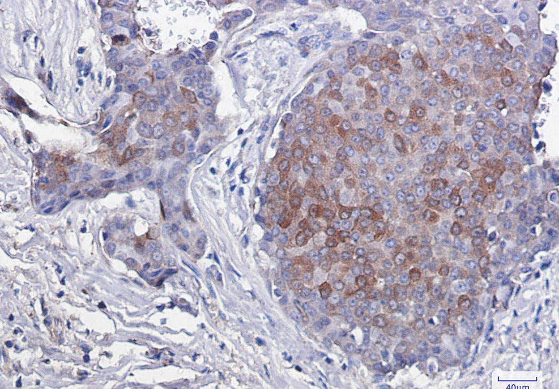 0 - [KO]Phospho-4E BP1 (Thr46) Rabbit mAb AP74966