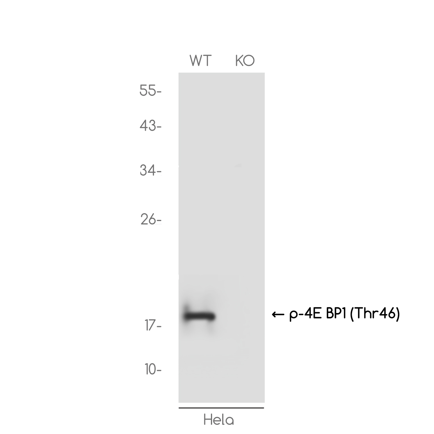 1 - [KO]Phospho-4E BP1 (Thr46) Rabbit mAb AP74966