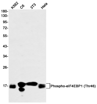 2 - [KO]Phospho-4E BP1 (Thr46) Rabbit mAb AP74966