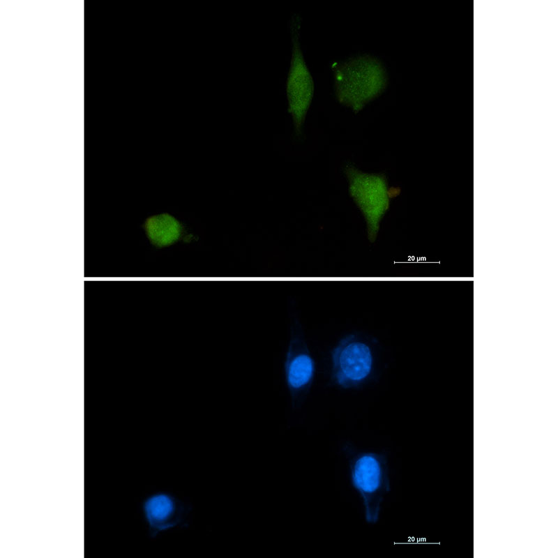 1 - Phospho-delta 1 Catenin (Tyr228) Rabbit mAb AP74968