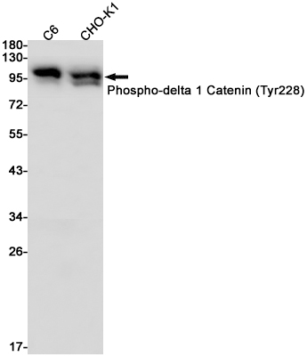 2 - Phospho-delta 1 Catenin (Tyr228) Rabbit mAb AP74968