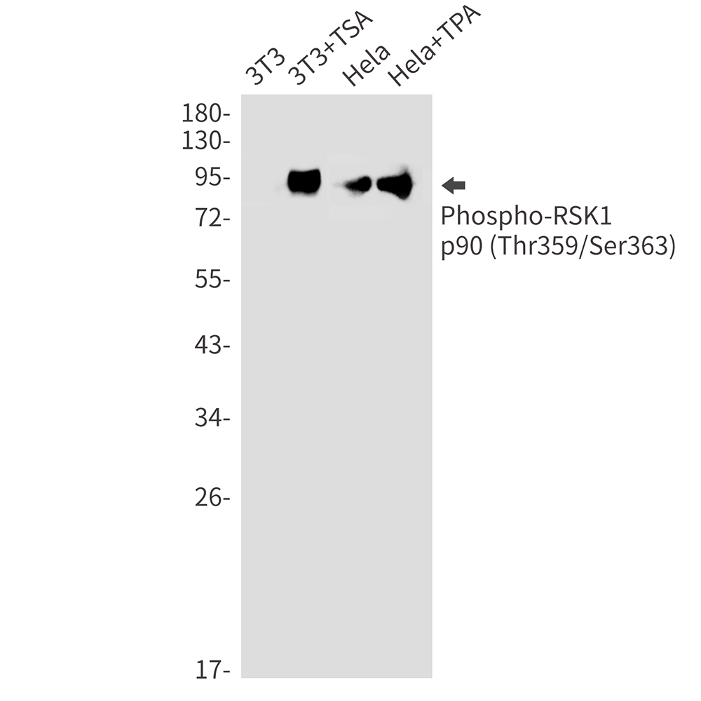 1 - Phospho-RSK1 p90 (Thr359/Ser363) Rabbit mAb AP74971