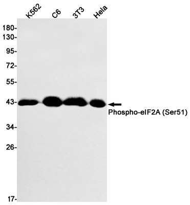1 - Phospho-EIF2S1 (Ser51) Rabbit mAb AP74973