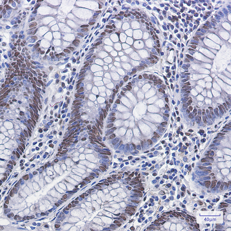 2 - Phospho-MDM2 (Ser166) Rabbit mAb AP74974
