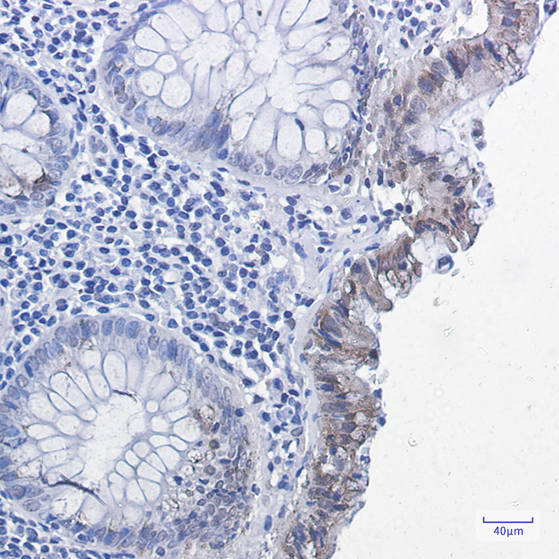 2 - Phospho-Smad2 (Ser255) Rabbit mAb AP74975