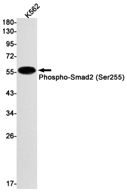 1 - Phospho-Smad2 (Ser255) Rabbit mAb AP74975