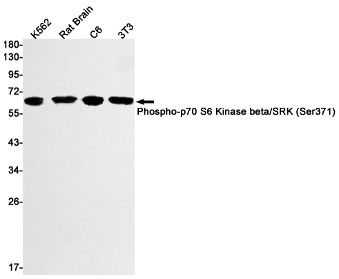 1 - Phospho-P70 S6 Kinase beta/SRK (Ser371) Rabbit mAb AP74976