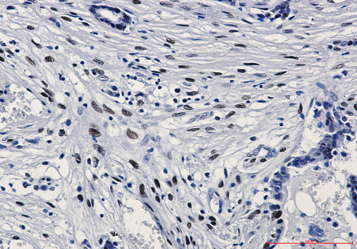 2 - Phospho-c-Jun (Ser63) Rabbit mAb AP74977