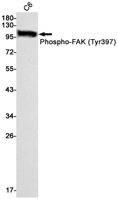 1 - Phospho-FAK (Tyr397) Rabbit mAb AP74978