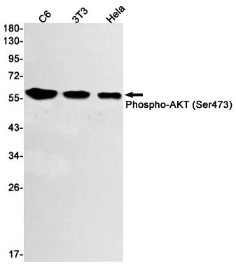 1 - Phospho-AKT1 (Ser473) Rabbit mAb AP74979