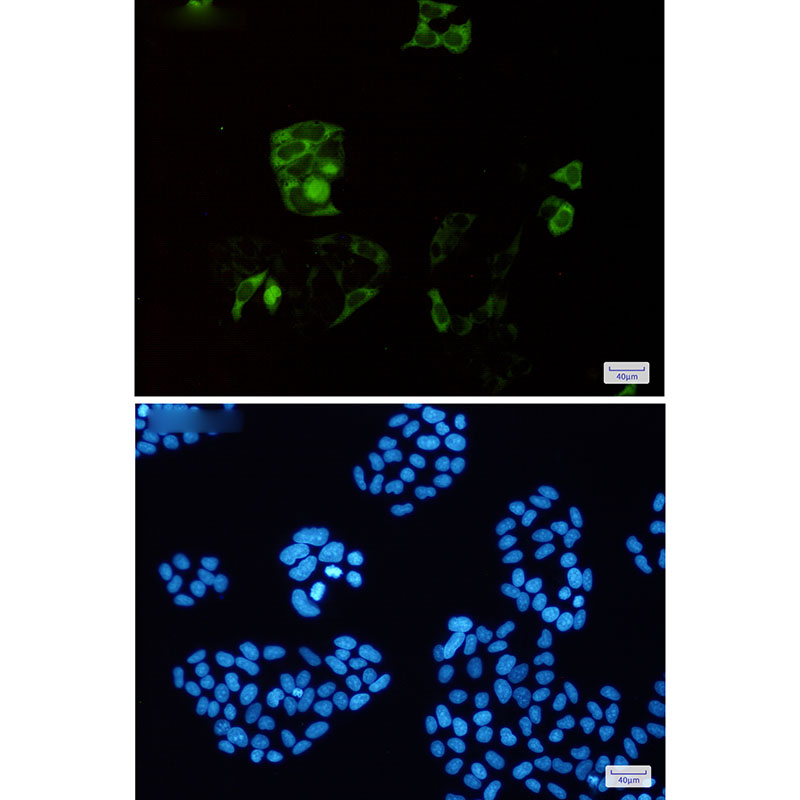4 - [KD]Cyclin B1 Rabbit mAb AP74983