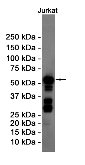 2 - [KD]Cyclin B1 Rabbit mAb AP74983