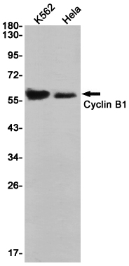8 - [KD]Cyclin B1 Rabbit mAb AP74983