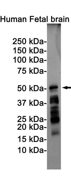 1 - Phospho-Tau (Ser198) Rabbit mAb AP74985