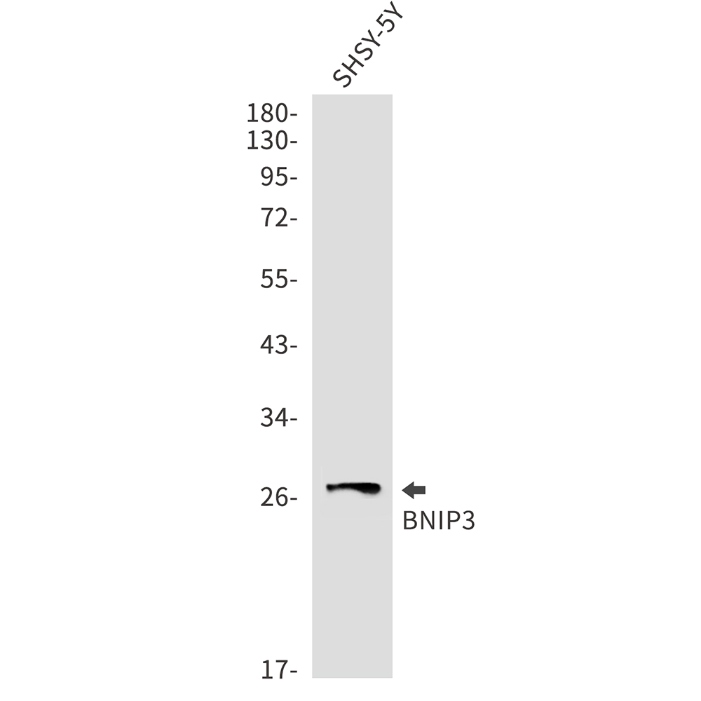 1 - BNIP3 Rabbit mAb AP74986