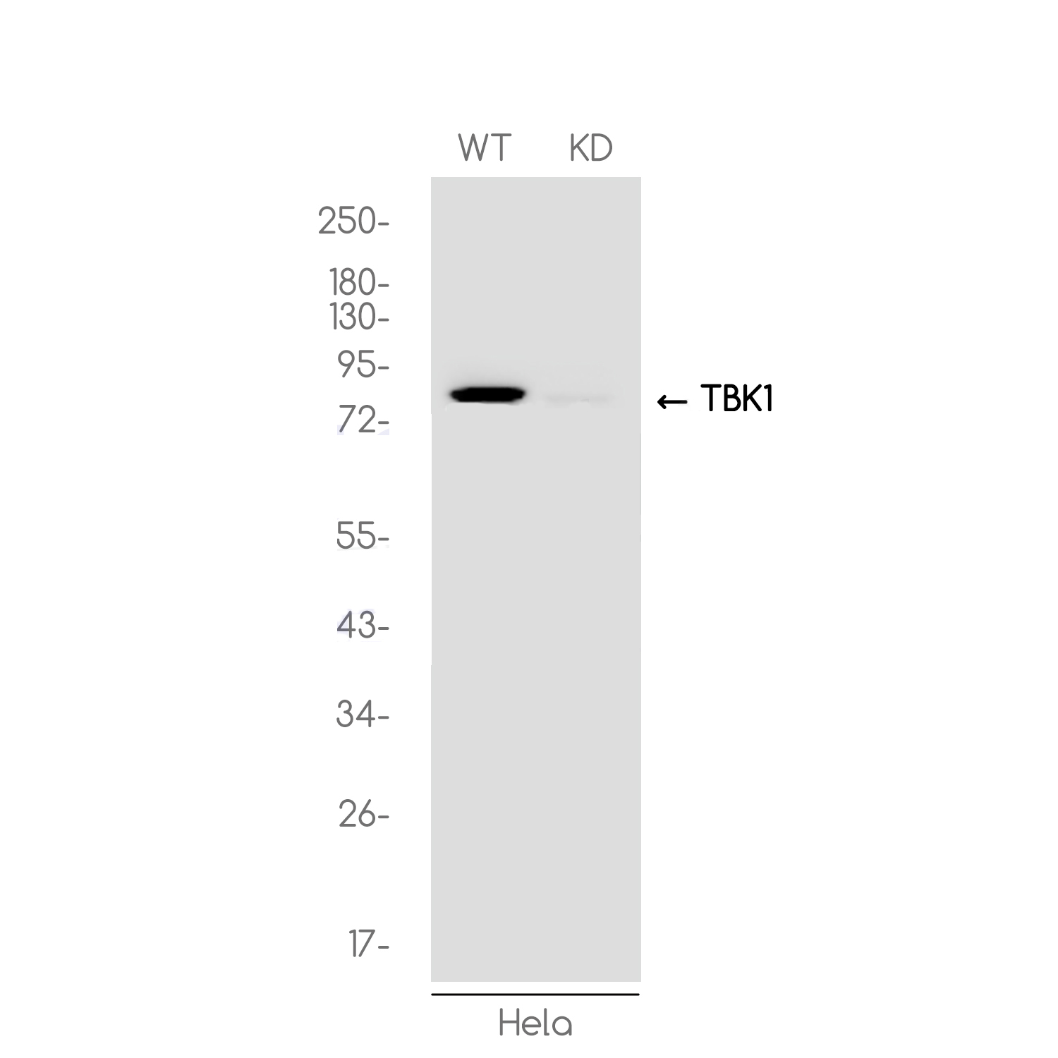 1 - [KD]NAK/TBK1 Rabbit mAb AP74988