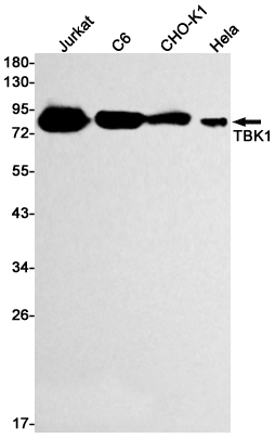 2 - [KD]NAK/TBK1 Rabbit mAb AP74988