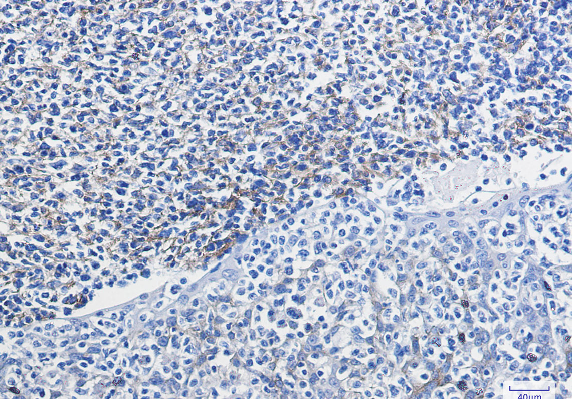 8 - VCAM1 Rabbit mAb AP74993