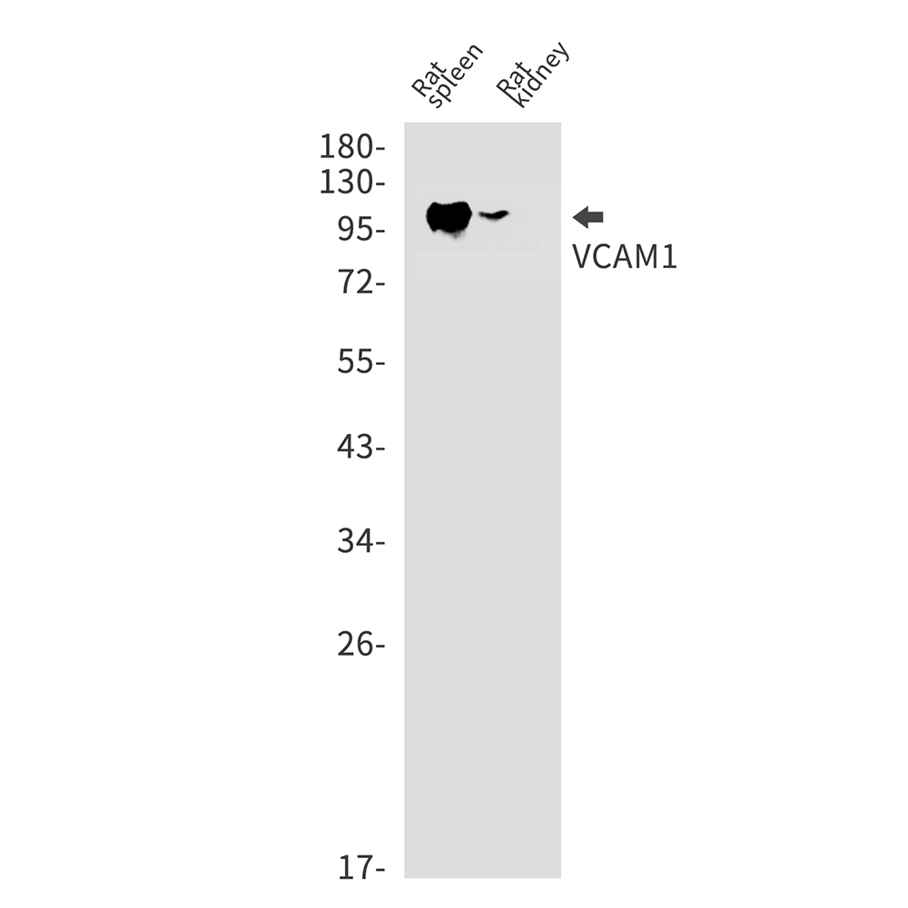 1 - VCAM1 Rabbit mAb AP74993