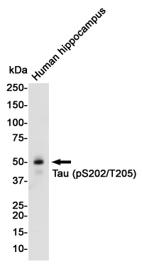 1 - Phospho-Tau (Ser202/Thr205) Rabbit mAb AP74995