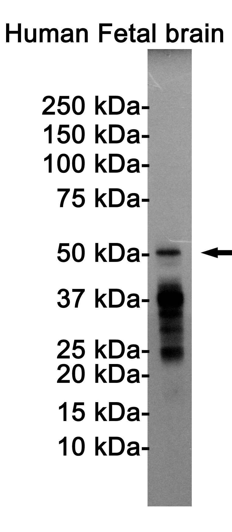 1 - Phospho-Tau (Thr205) Rabbit mAb AP74996