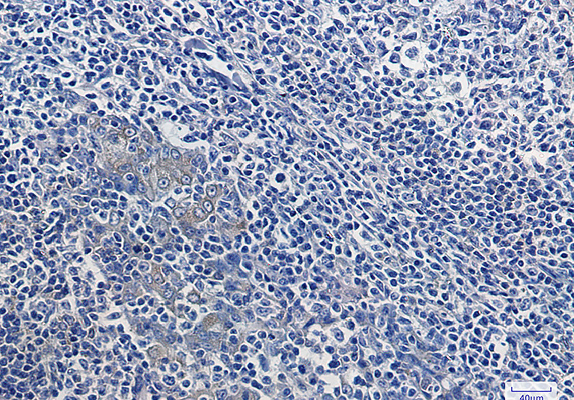 5 - IKB alpha Rabbit mAb AP74997