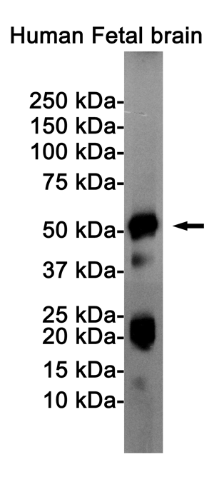 1 - Phospho-Tau (Ser404) Rabbit mAb AP74999