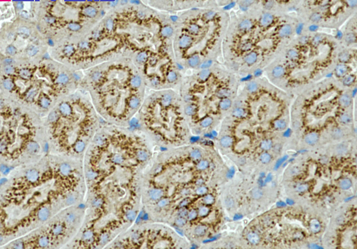 1 - CD63 Rabbit mAb AP75000