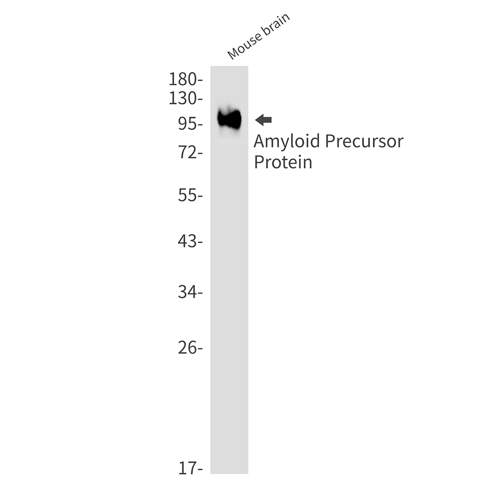 1 - Amyloid Precursor Protein Rabbit mAb AP75002