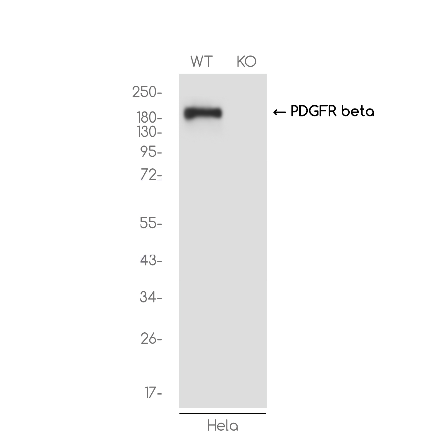 1 - [KO]PDGFR beta Rabbit mAb AP75003