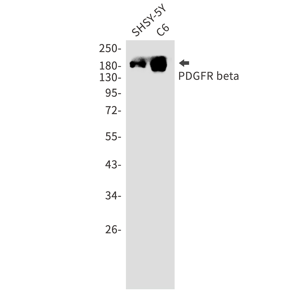 2 - [KO]PDGFR beta Rabbit mAb AP75003