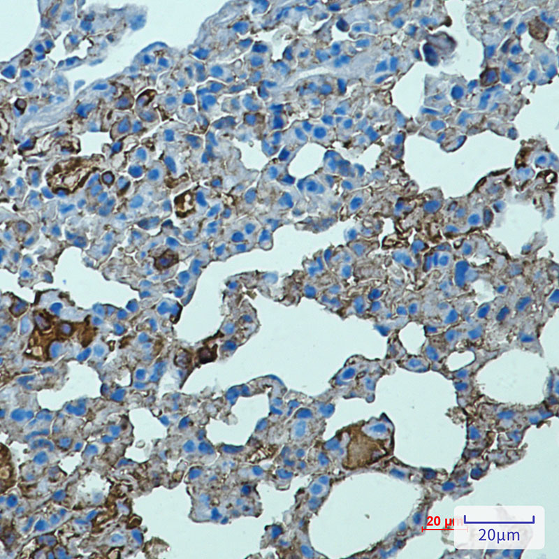 1 - TLR2 Rabbit mAb AP75005