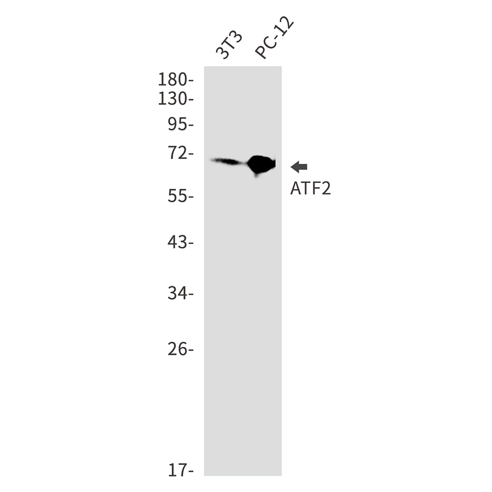 1 - ATF2 Rabbit mAb AP75009