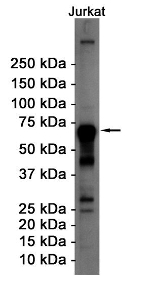 2 - ATF2 Rabbit mAb AP75009