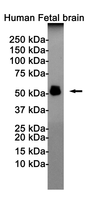 1 - Phospho-Tau (Thr181) Rabbit mAb AP75013