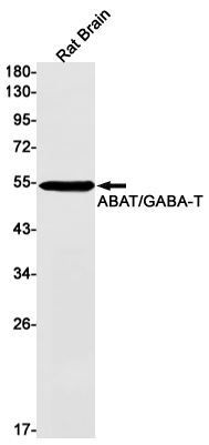 1 - ABAT Rabbit mAb AP75022
