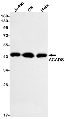 5 - ACADS/SCAD Rabbit mAb AP75024