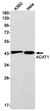 1 - ACAT1 Rabbit mAb AP75025
