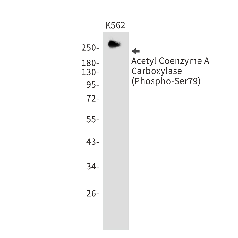 1 - [KD]Phospho-ACC1 (Ser79) Rabbit mAb AP75026