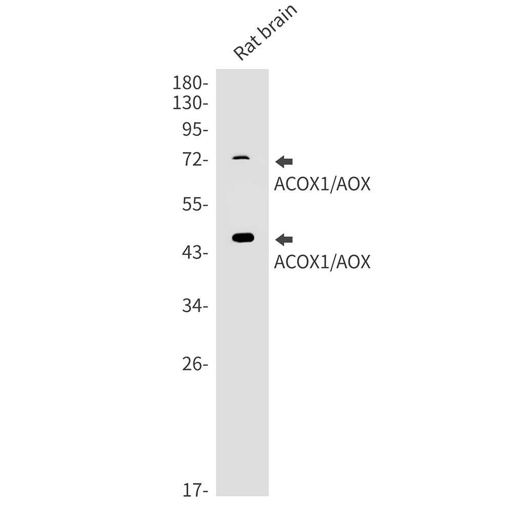 1 - ACOX1 Rabbit mAb AP75028