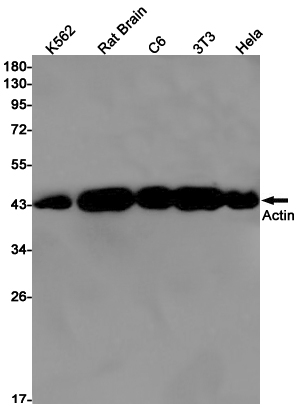 1 - ACTA1 Rabbit mAb AP75030