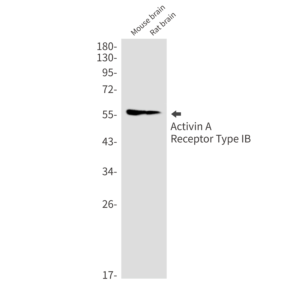 1 - Activin A Receptor Type IB/ALK-4 Rabbit mAb AP75031