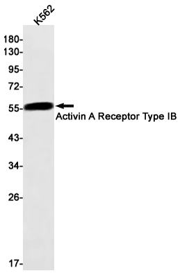 4 - Activin A Receptor Type IB/ALK-4 Rabbit mAb AP75031