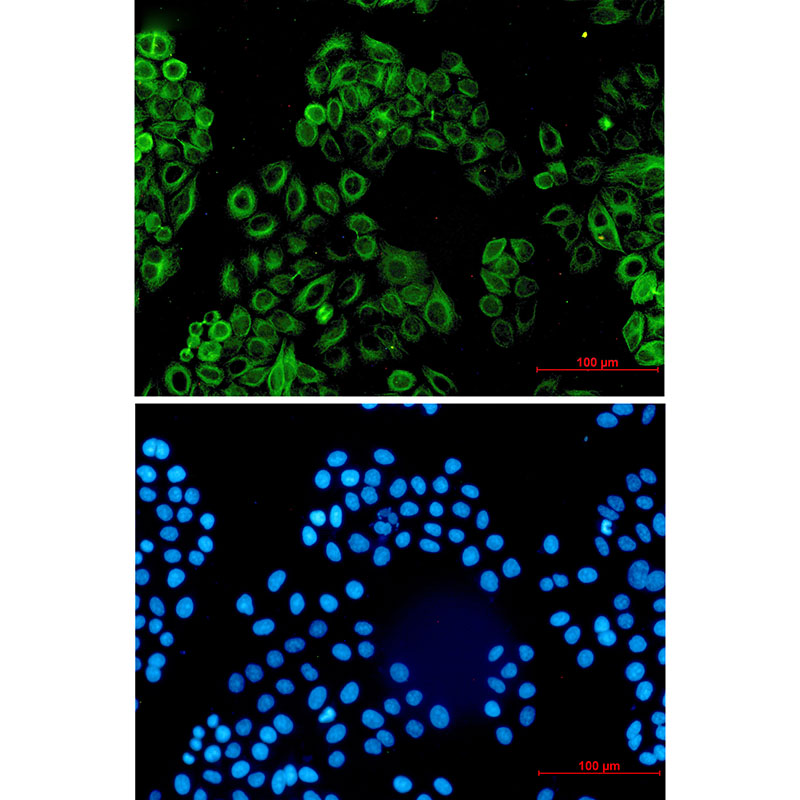 8 - Activin A Receptor Type IB/ALK-4 Rabbit mAb AP75032