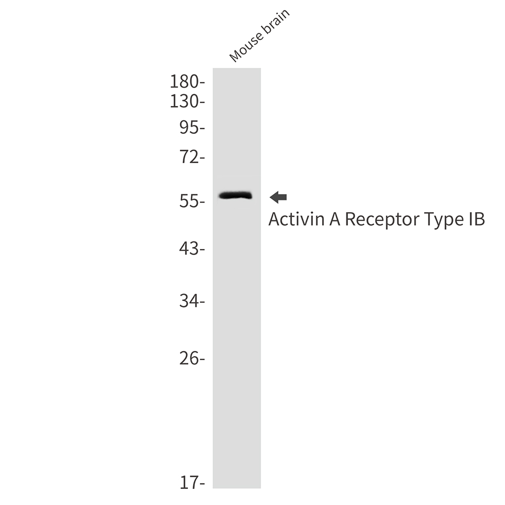 1 - Activin A Receptor Type IB/ALK-4 Rabbit mAb AP75032