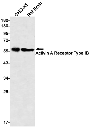 2 - Activin A Receptor Type IB/ALK-4 Rabbit mAb AP75032