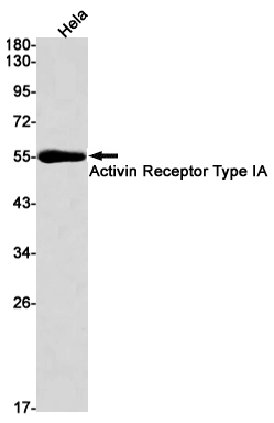 5 - ACVR1  Rabbit mAb AP75033